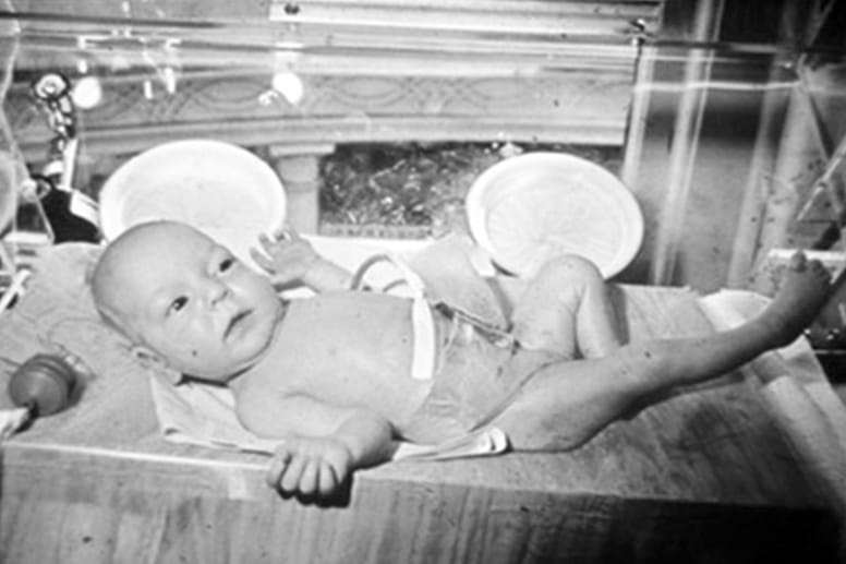 Dudrick baby 2