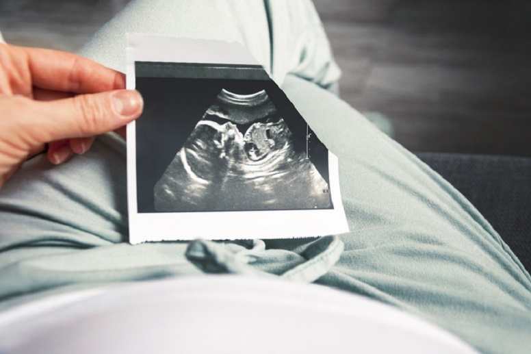 ultrasound picture